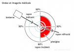 Ondes et imagerie medicale