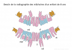 Dessin de la radiographie des mâchoires 8 ans
